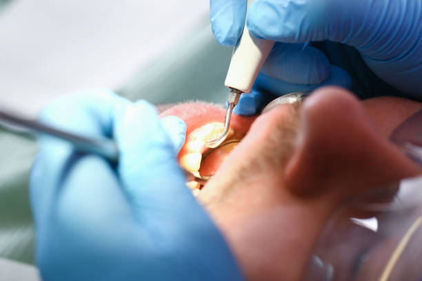 Best Tooth Infection Emergency Dentist  in Garden City South, NY